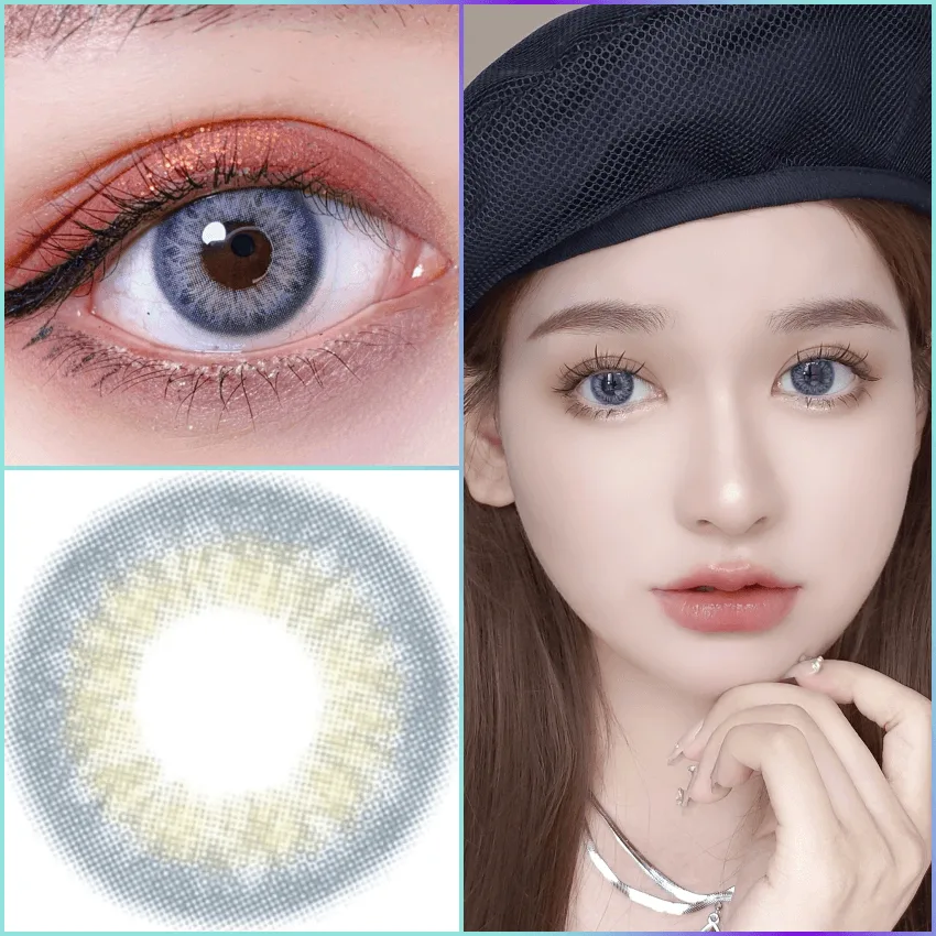 Sclera Lenses vs Circle Lenses: Key Differences