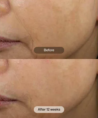 .D·E·J Face Cream®