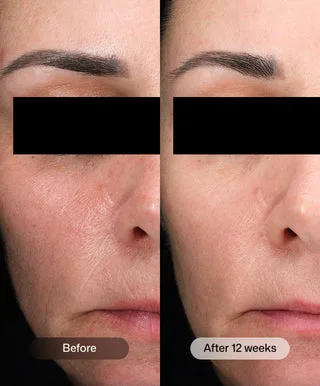 .D·E·J Daily Boosting Serum®