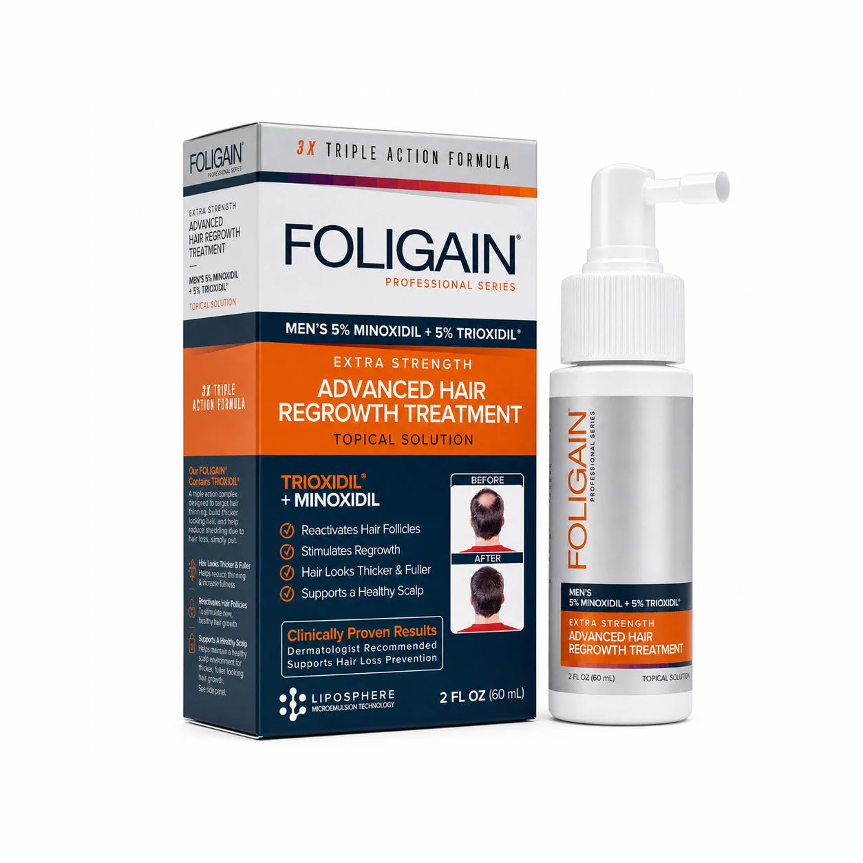 FOLIGAIN 5% Minoxidil vs. hårvækstshampoo til mænd