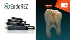 EndoREZ™-Root Canal Sealer
