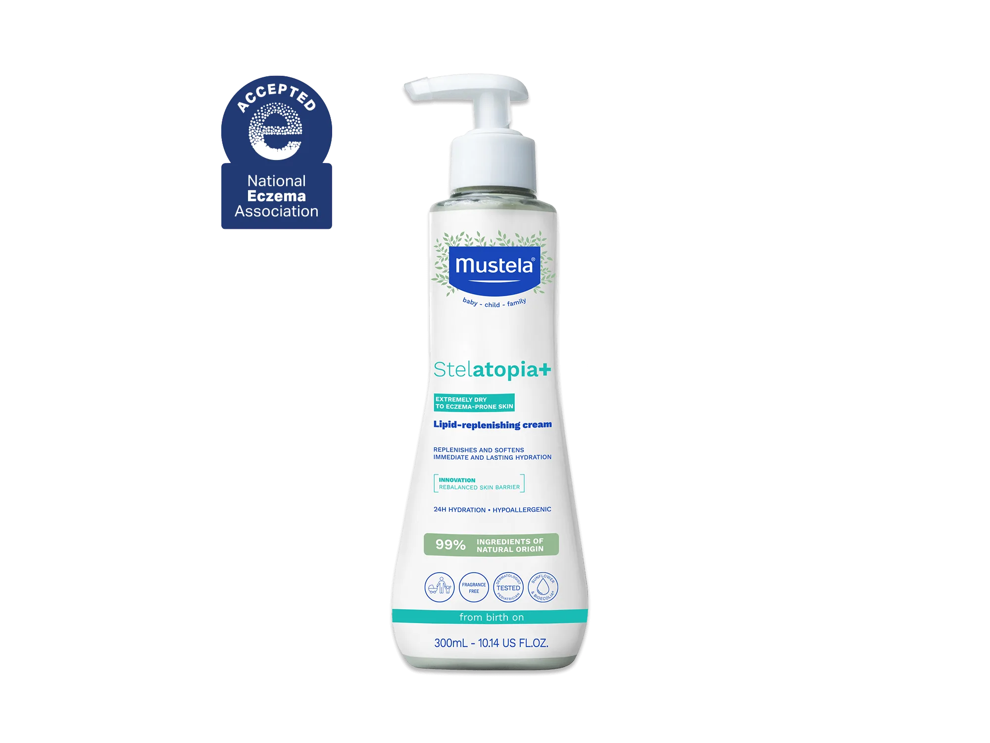 How to Prevent and Treat Cradle Cap: Gentle Solutions for Baby’s Scalp