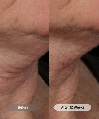 Nectifirm® Advanced