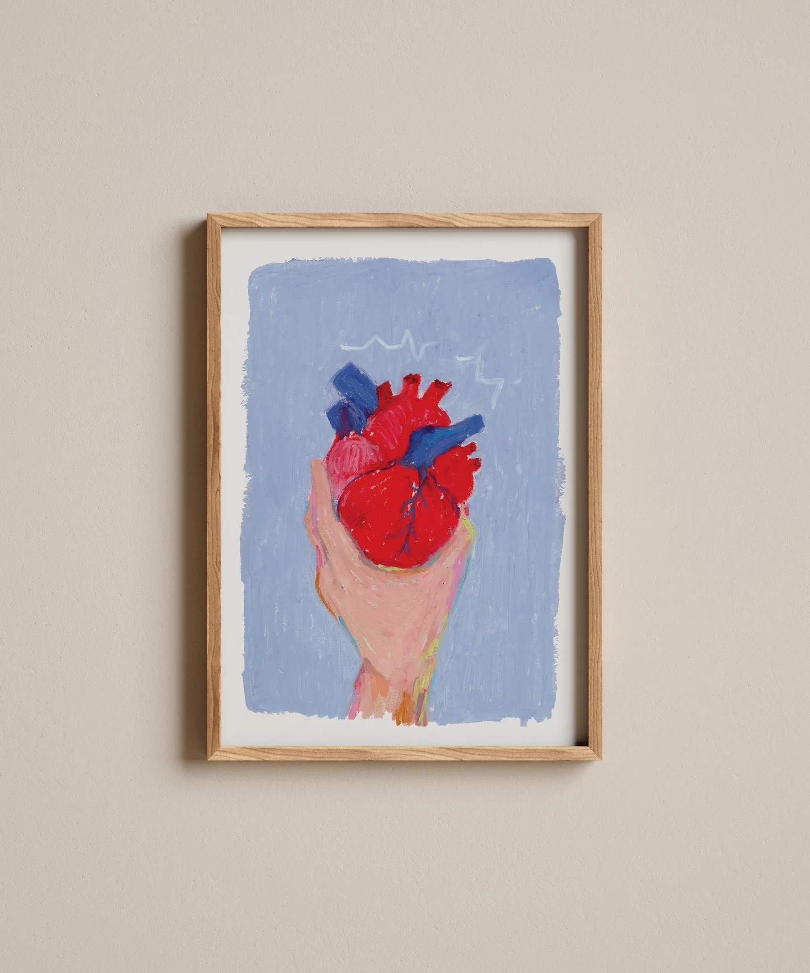 Anxiété | Impression d'art